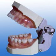 牙龈病模型