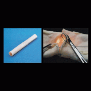 肠管吻合模型(20mm)
